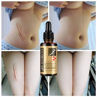 The Skin's Surface - Laikou Essential Massage Oils Scar